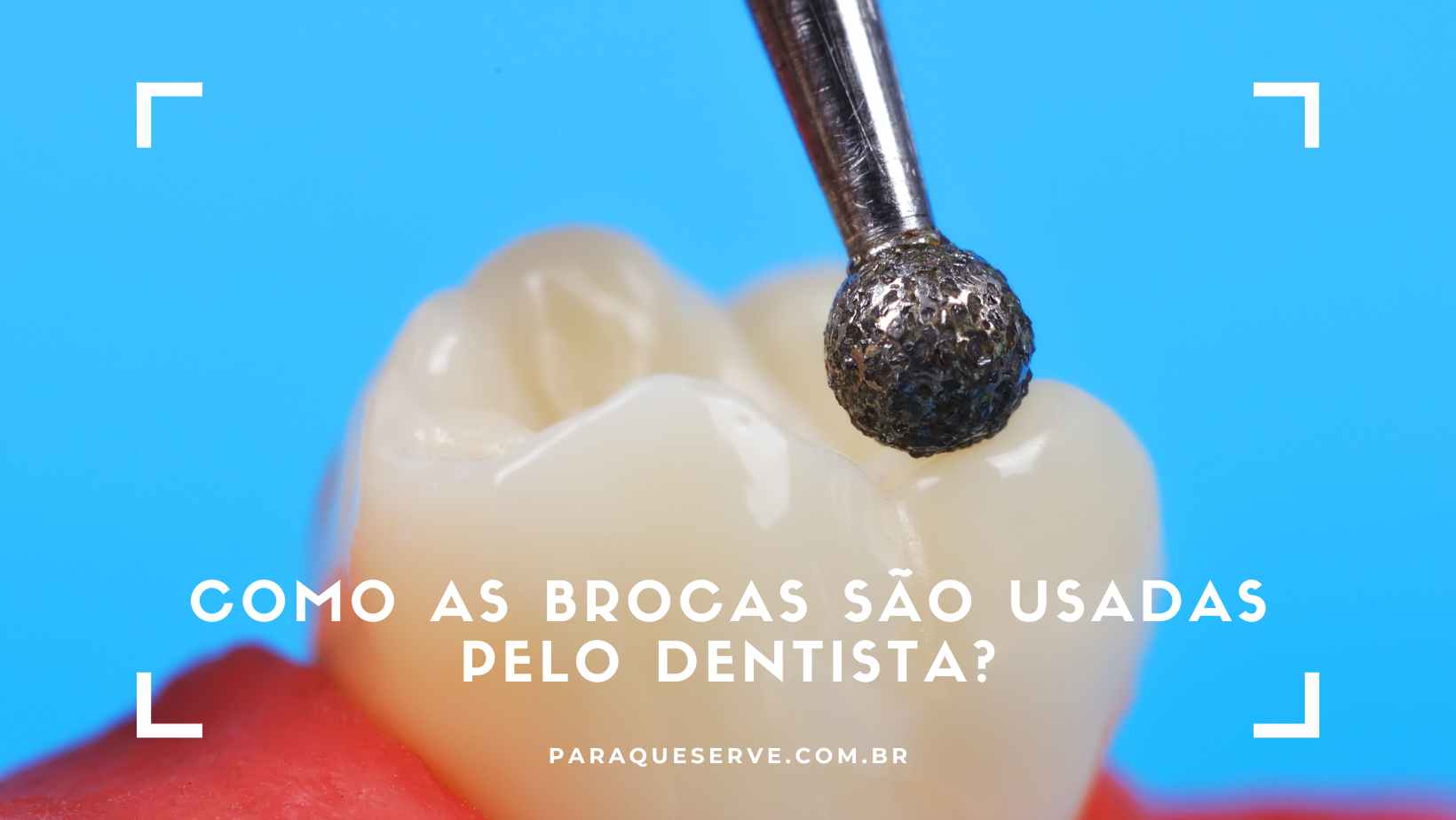 Como as Brocas são usadas pelo dentista?