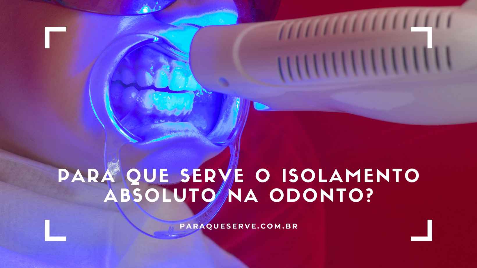 Para que serve o Isolamento absoluto na odonto