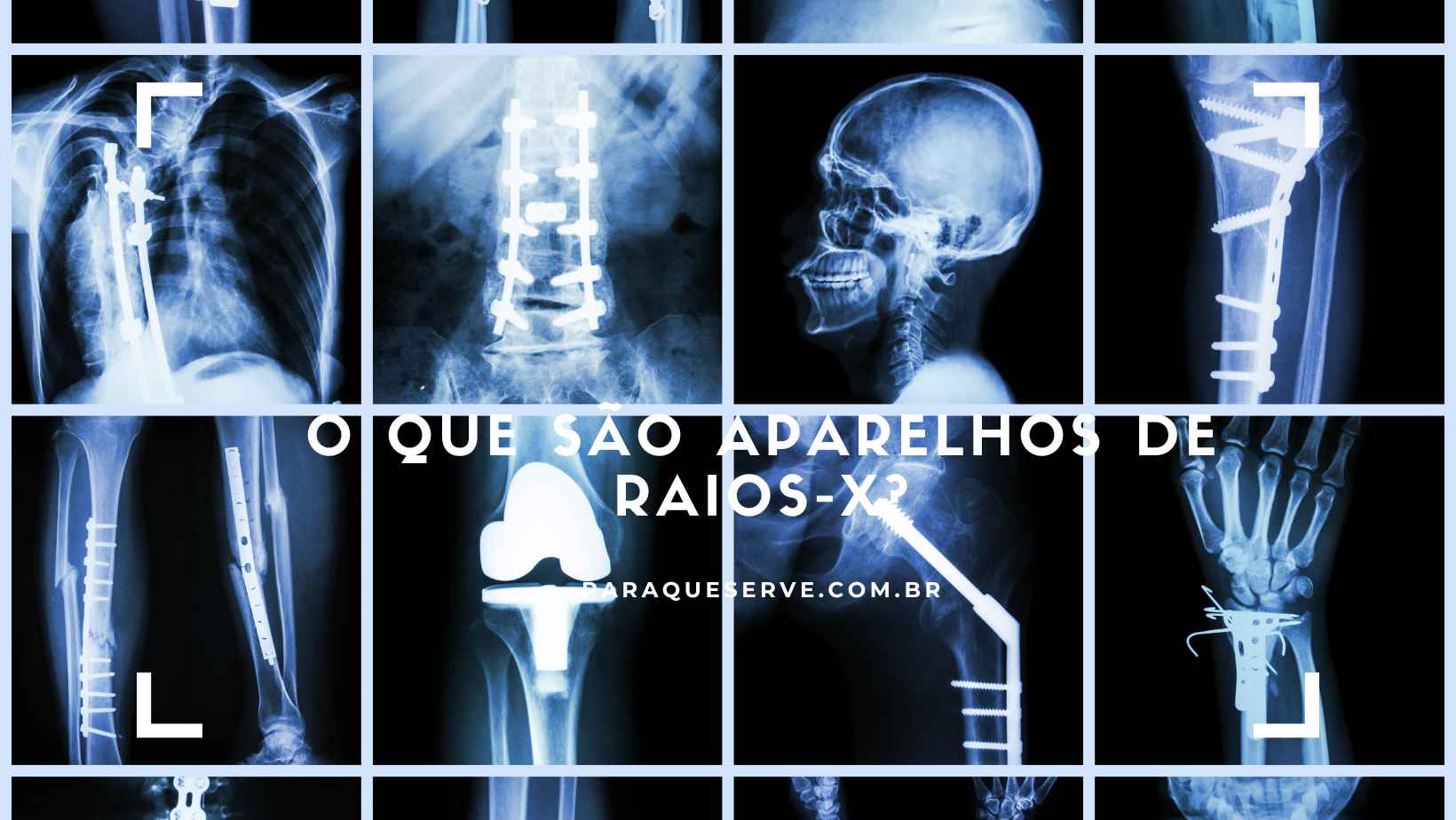 O que são aparelhos de raios-X?